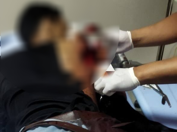 Korban Tawuran Antar Pelajar